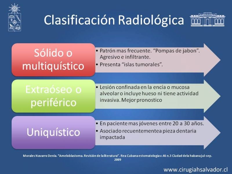Diapositiva 9 de Ameloblastoma