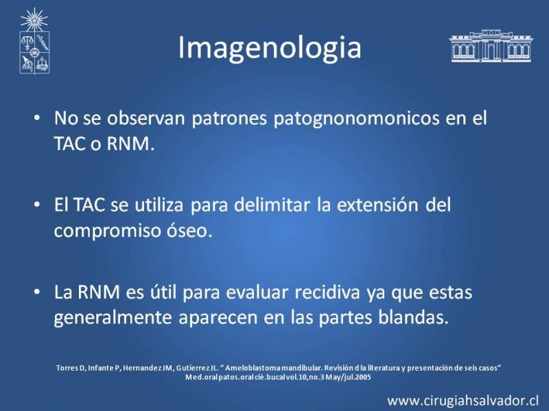 Diapositiva 11 de Ameloblastoma