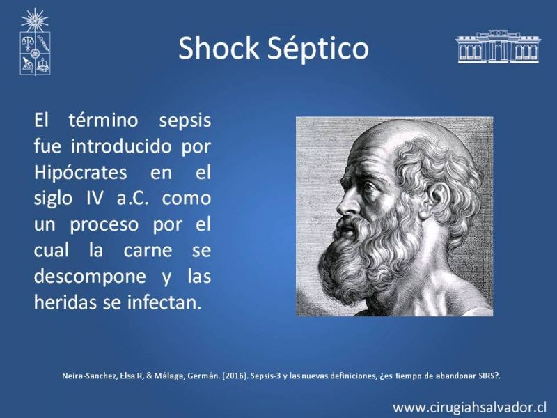 Diapositiva 5 de Shock Séptico