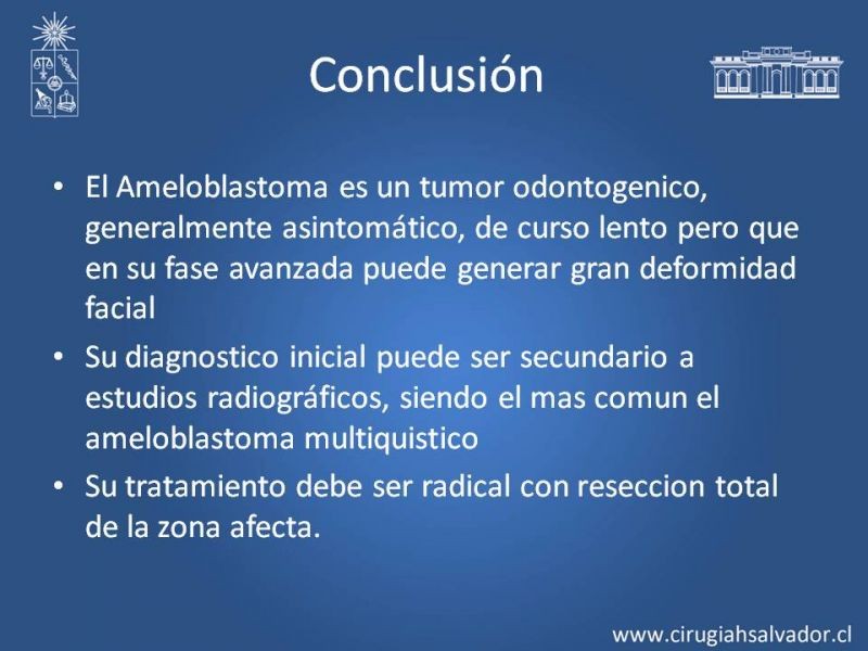Diapositiva 22 de Ameloblastoma