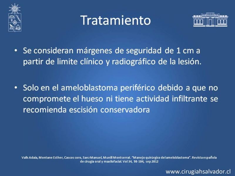 Diapositiva 21 de Ameloblastoma