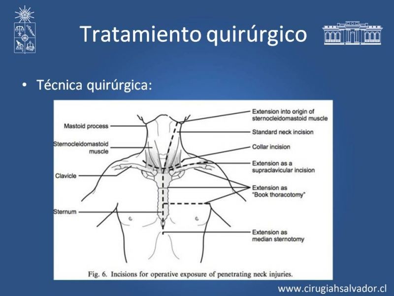 Diapositiva 20 de Trauma Carotídeo