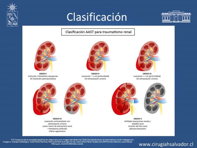 Diapositiva 7 de Trauma Renal