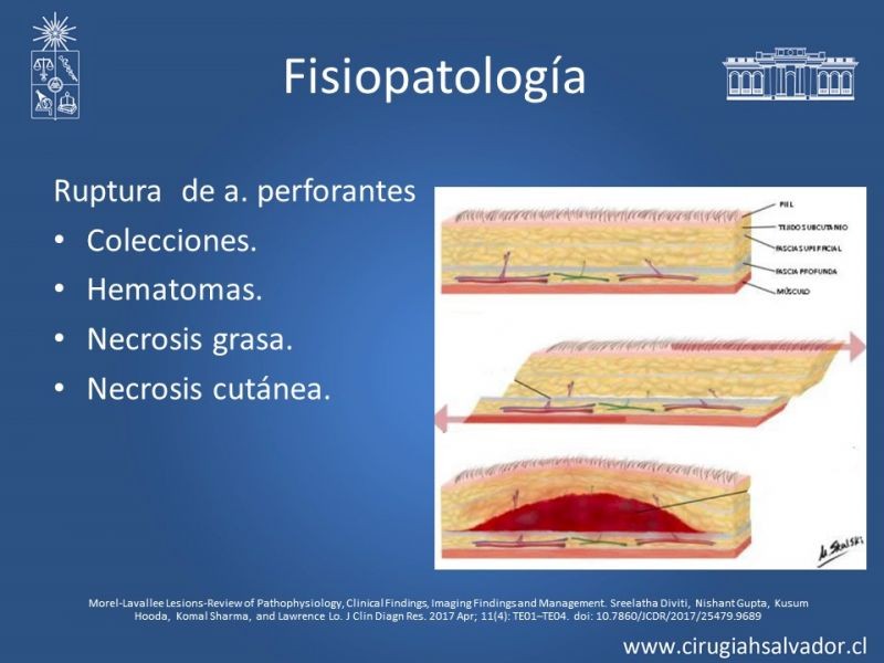 Diapositiva 6 de Desforramiento