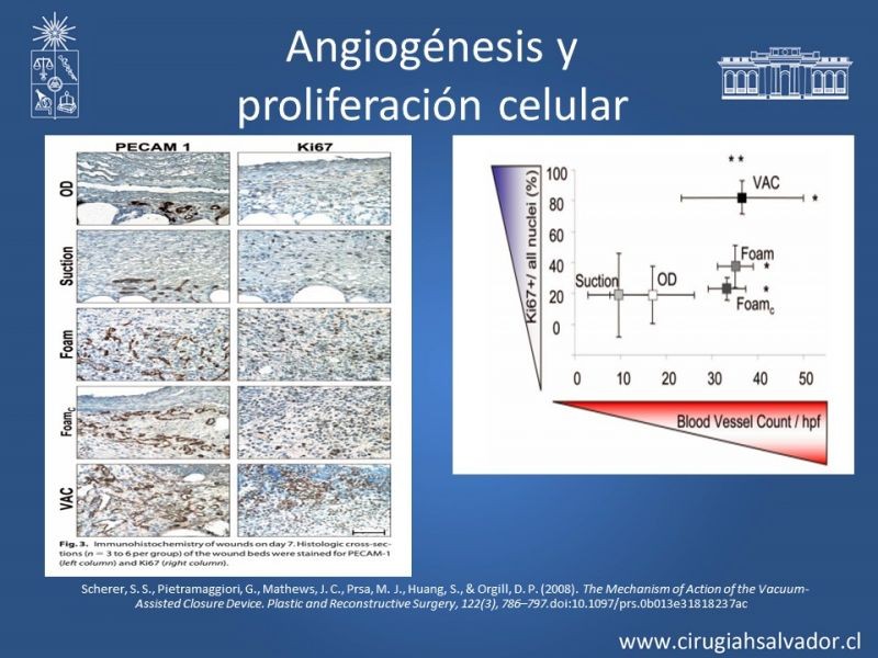Diapositiva 13 de Terapia de presión negativa