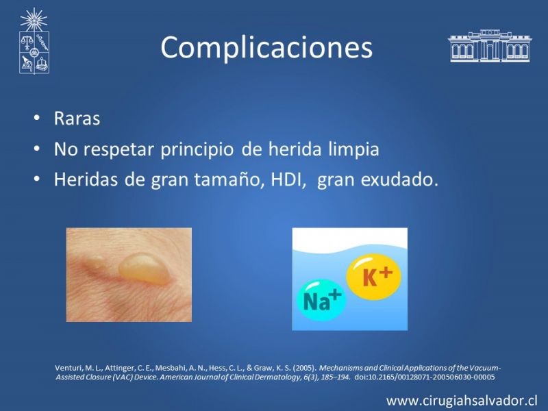 Diapositiva 19 de Terapia de presión negativa