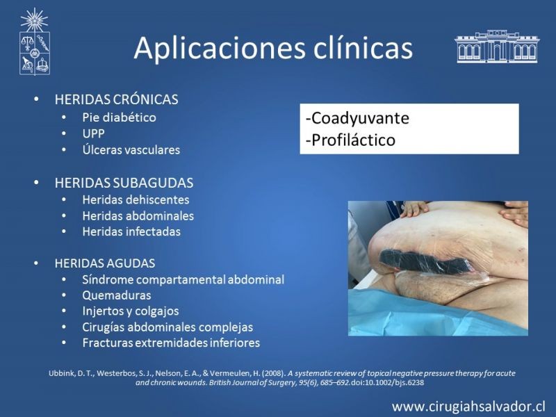 Diapositiva 20 de Terapia de presión negativa