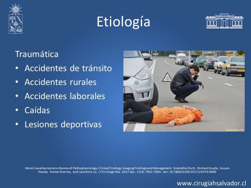 Diapositiva 4 de Desforramiento