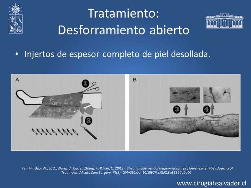 Diapositiva 16 de Desforramiento