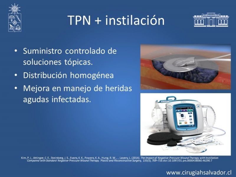 Diapositiva 29 de Terapia de presión negativa