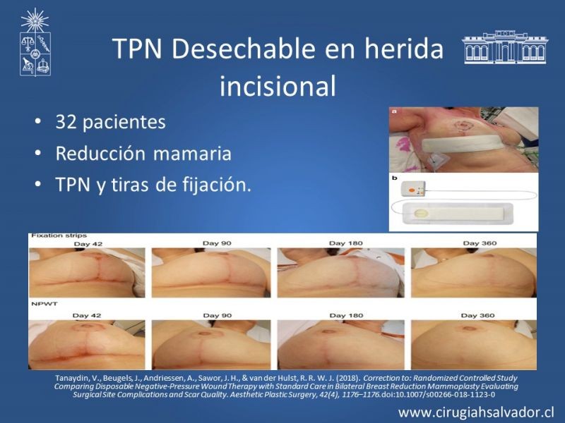 Diapositiva 31 de Terapia de presión negativa