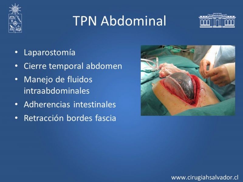 Diapositiva 27 de Terapia de presión negativa