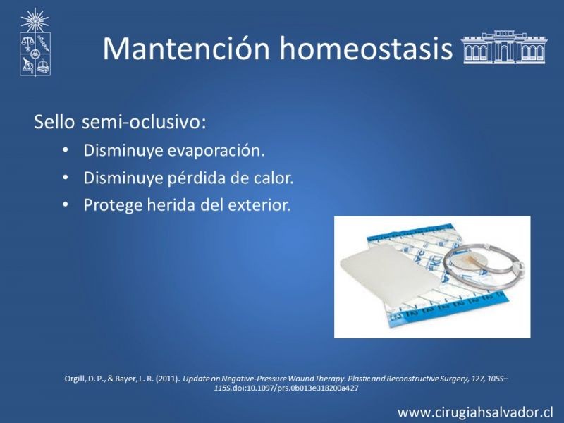 Diapositiva 12 de Terapia de presión negativa