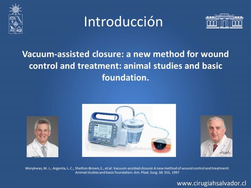 Diapositiva 3 de Terapia de presión negativa