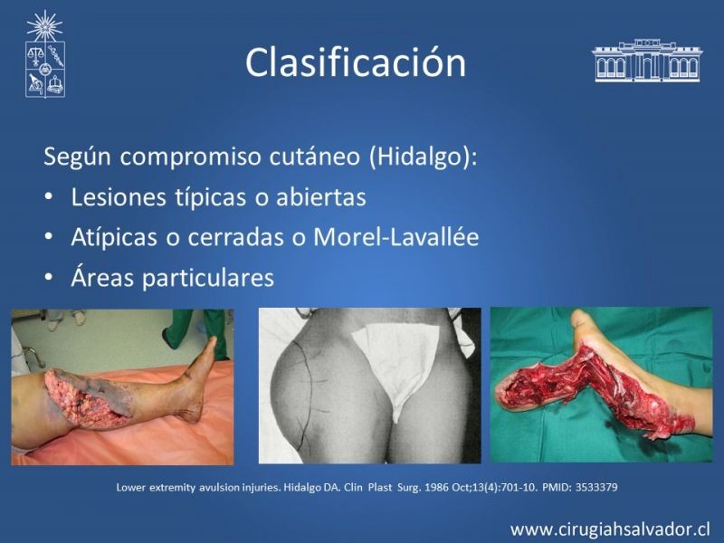 Diapositiva 8 de Desforramiento
