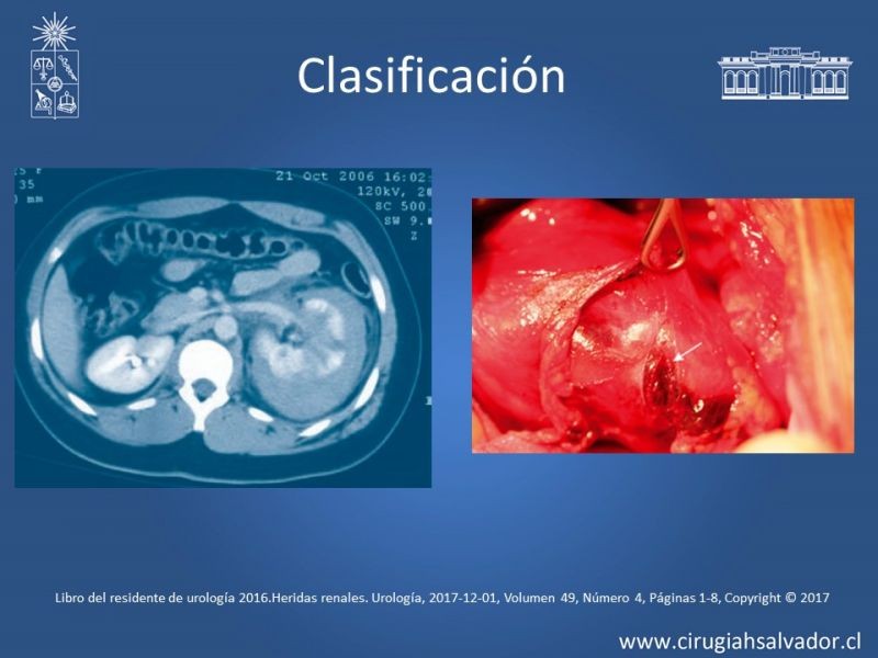 Diapositiva 8 de Trauma Renal