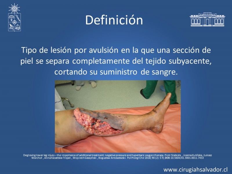 Diapositiva 2 de Desforramiento