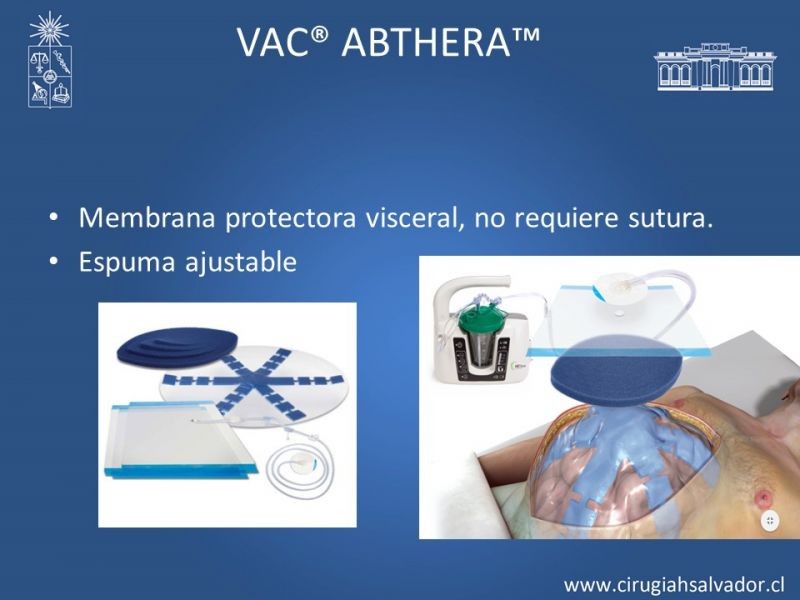 Diapositiva 28 de Terapia de presión negativa