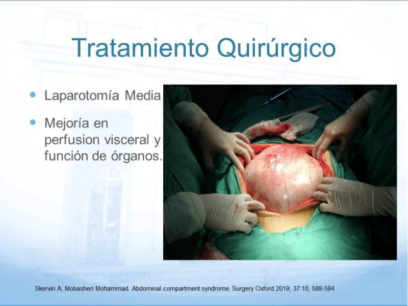 Diapositiva 13 de Síndrome Compartimental Abdominal