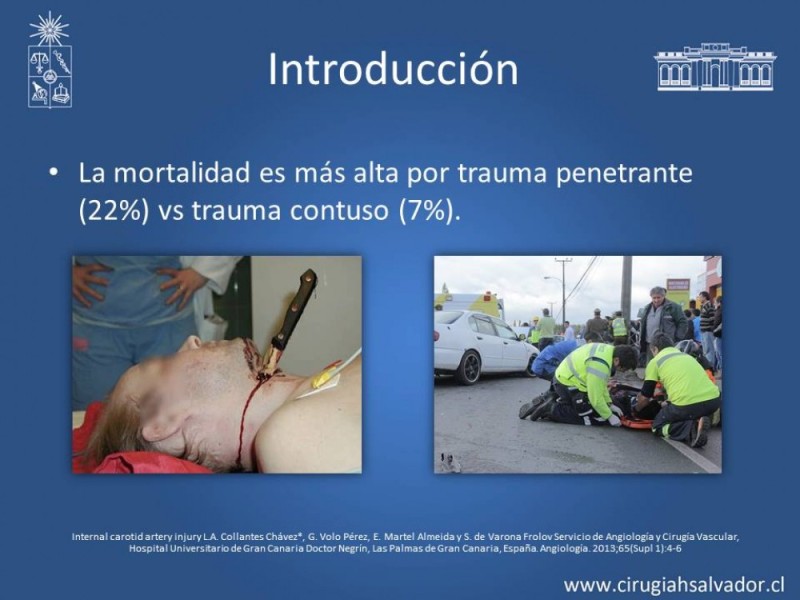 Diapositiva 6 de Trauma Carotídeo
