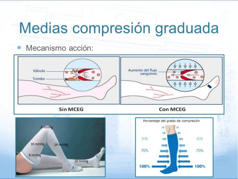 Diapositiva 9 de Estenosis Carotídea