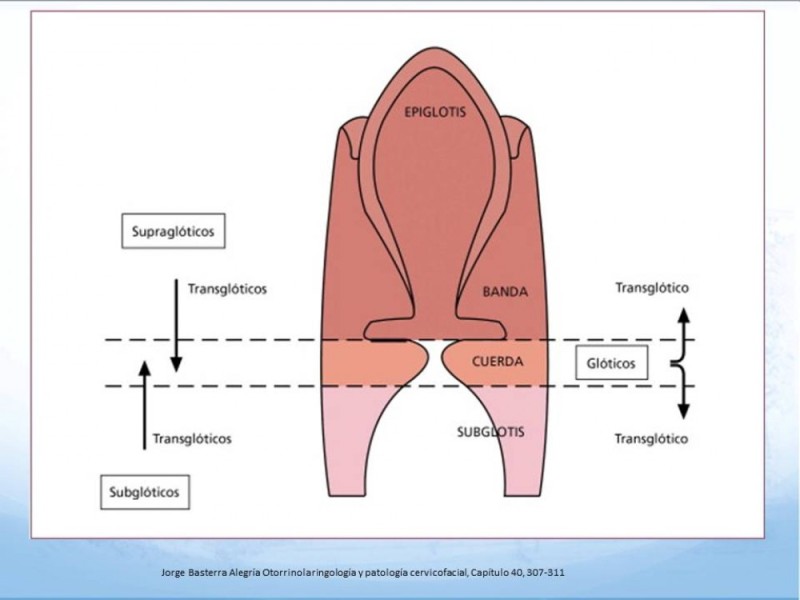 Diapositiva 3 de Cáncer Laringeo