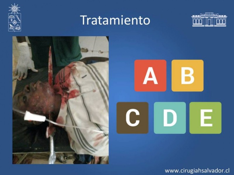Diapositiva 15 de Trauma Carotídeo