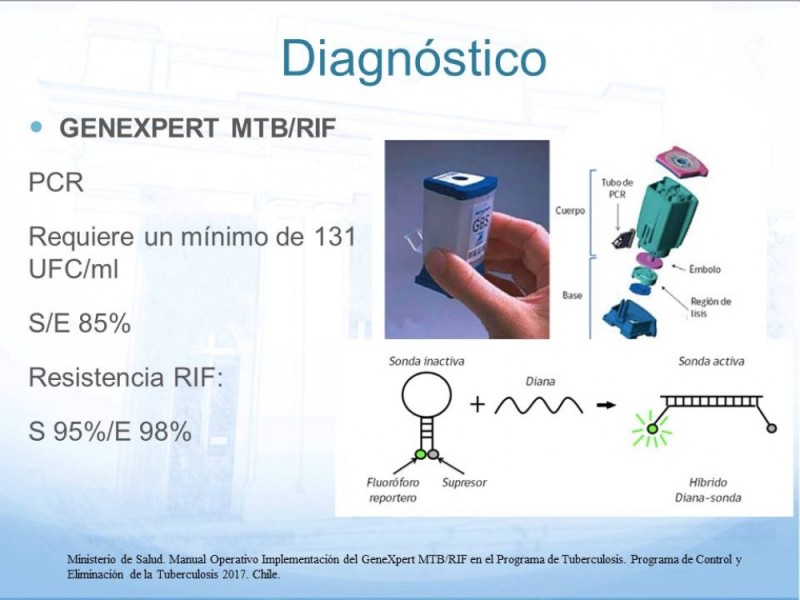 Diapositiva 10 de Tuberculosis Ganglionar
