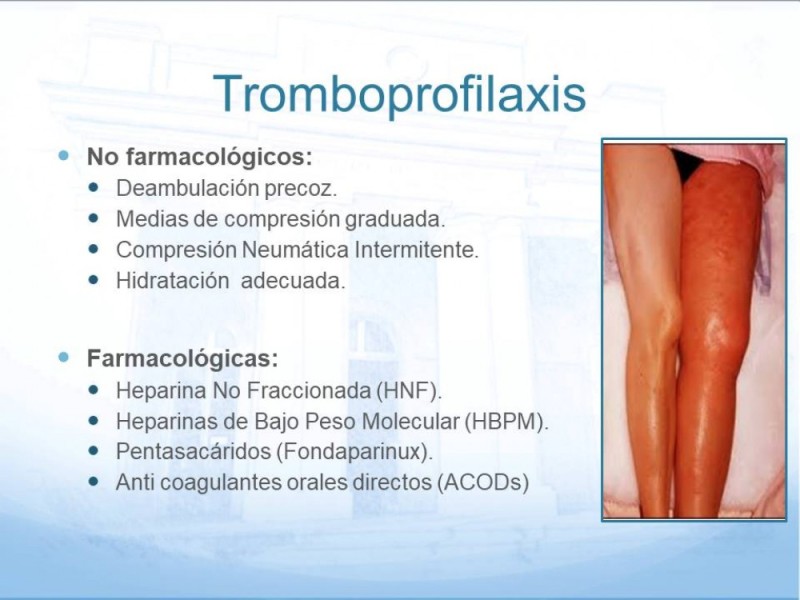 Diapositiva 7 de Tromboprofilaxis en cirugía