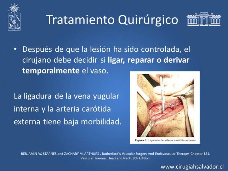 Diapositiva 41 de Trauma Carotídeo