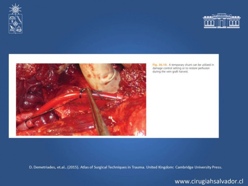 Diapositiva 36 de Trauma Vascular Periférico