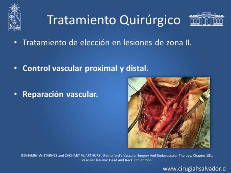 Diapositiva 26 de Trauma Carotídeo