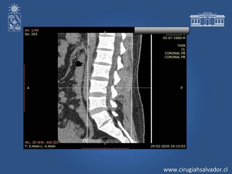 Diapositiva 13 de Trauma Esplénico