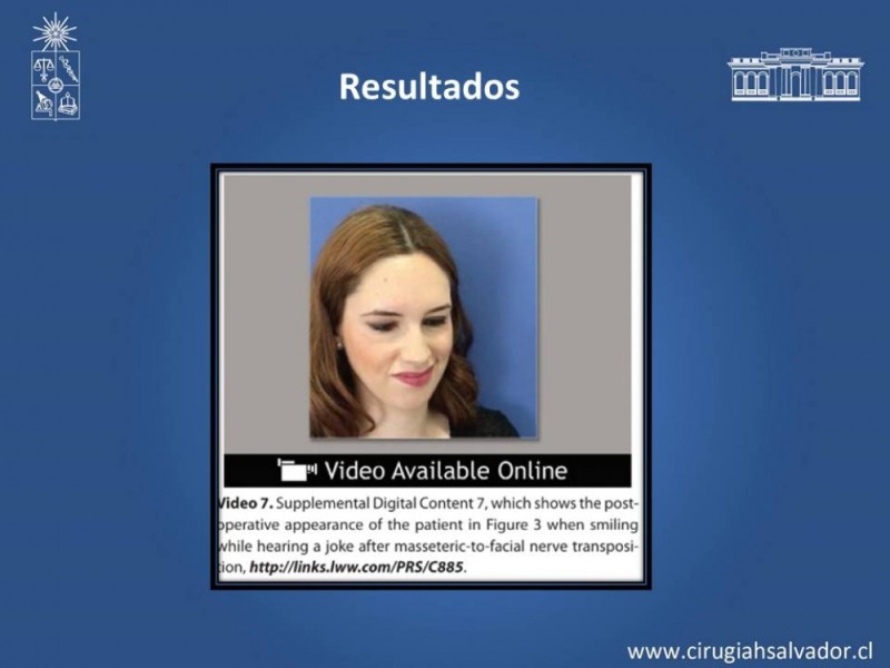 Diapositiva 22 de Injerto Nervioso facial vs transposición Nervio Masetérico