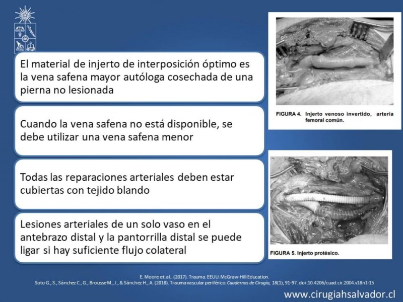 Diapositiva 22 de Trauma Vascular Periférico