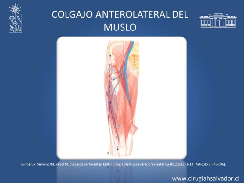 Diapositiva 33 de Aplicación Colgajos Perforantes