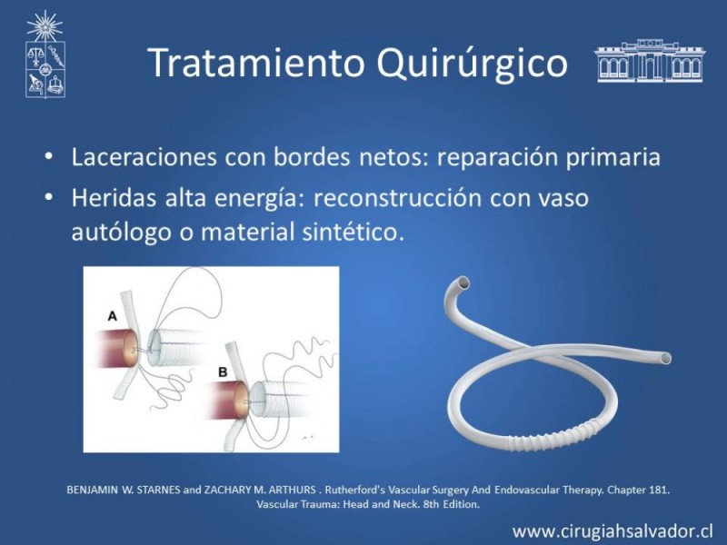 Diapositiva 43 de Trauma Carotídeo