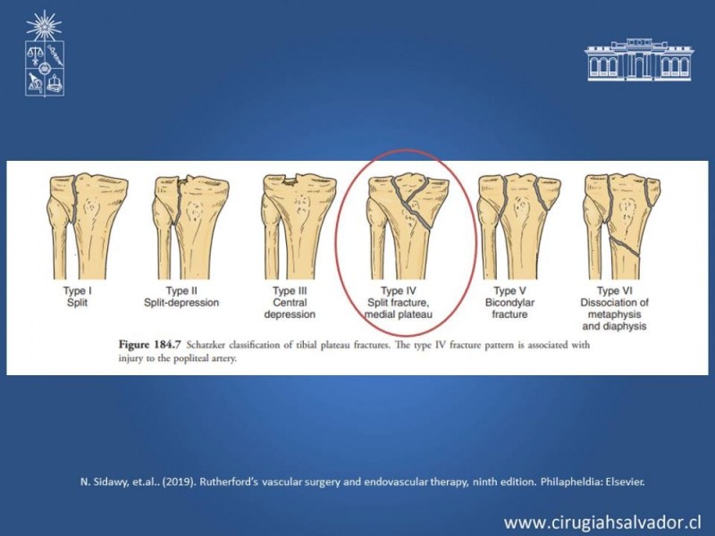 Diapositiva 6 de Trauma Vascular Periférico