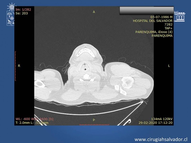 Diapositiva 21 de Trauma Esplénico
