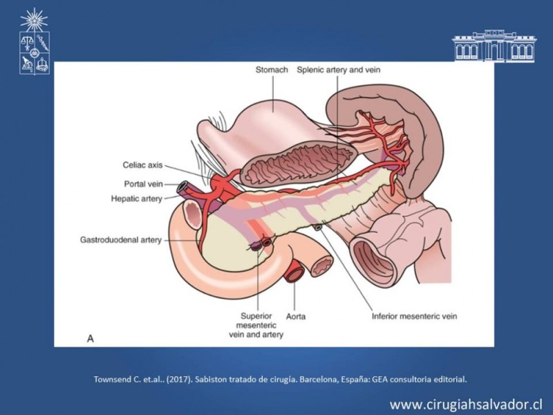 Diapositiva 35 de Trauma Esplénico