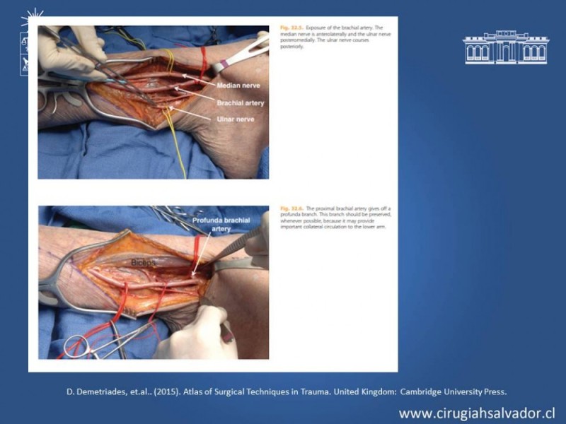 Diapositiva 27 de Trauma Vascular Periférico