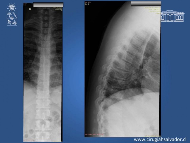 Diapositiva 9 de Trauma Esplénico