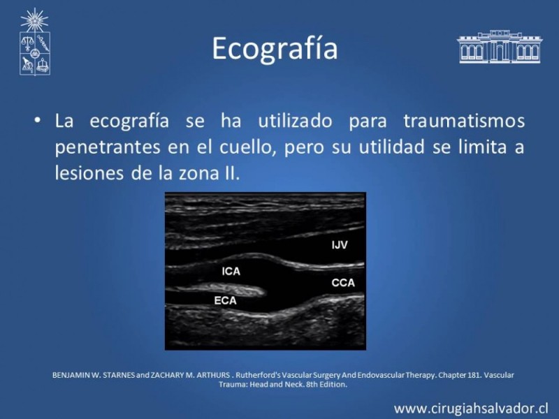 Diapositiva 20 de Trauma Carotídeo