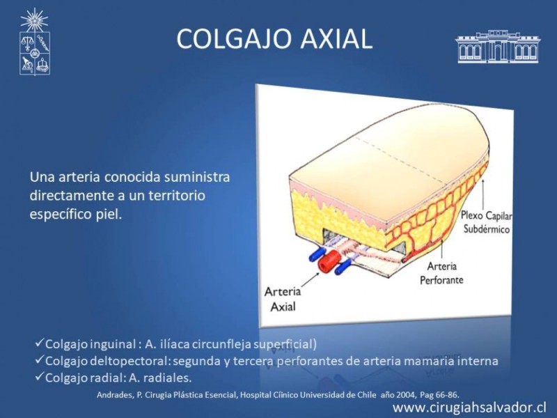 Diapositiva 8 de Aplicación Colgajos Perforantes