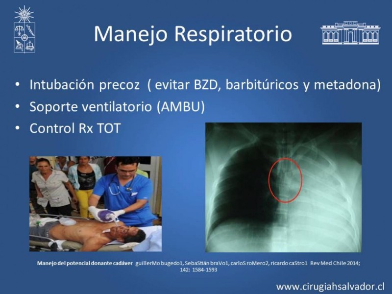 Diapositiva 9 de Muerte cerebral: manejo inicial del posible donante
