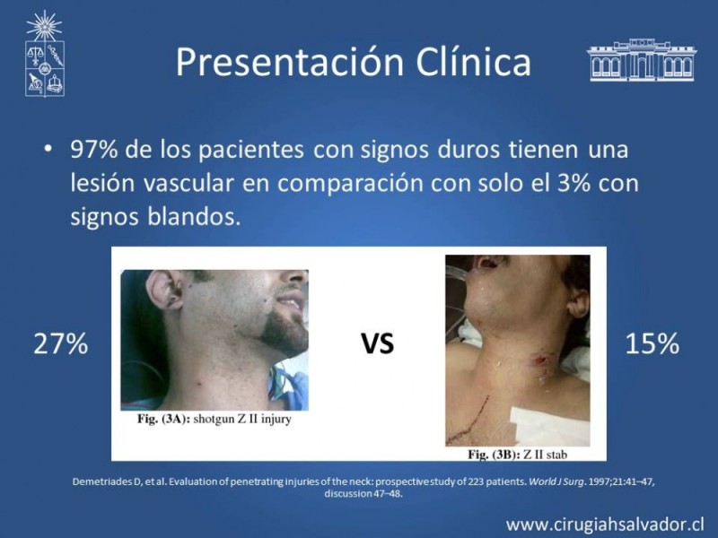 Diapositiva 13 de Trauma Carotídeo