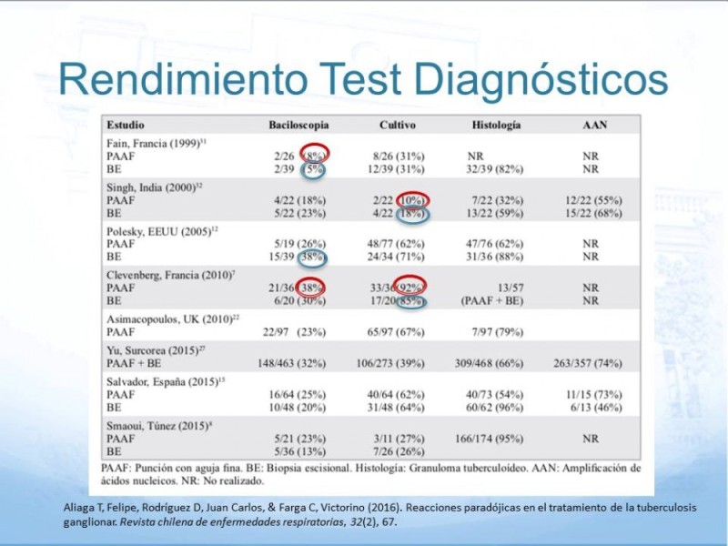 Diapositiva 9 de Tuberculosis Ganglionar