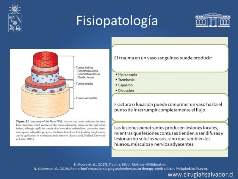 Diapositiva 5 de Trauma Vascular Periférico