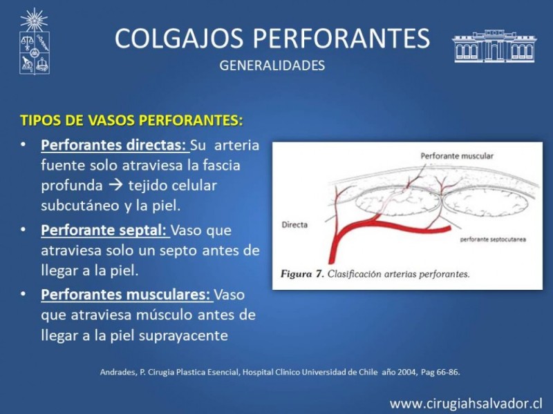 Diapositiva 11 de Aplicación Colgajos Perforantes