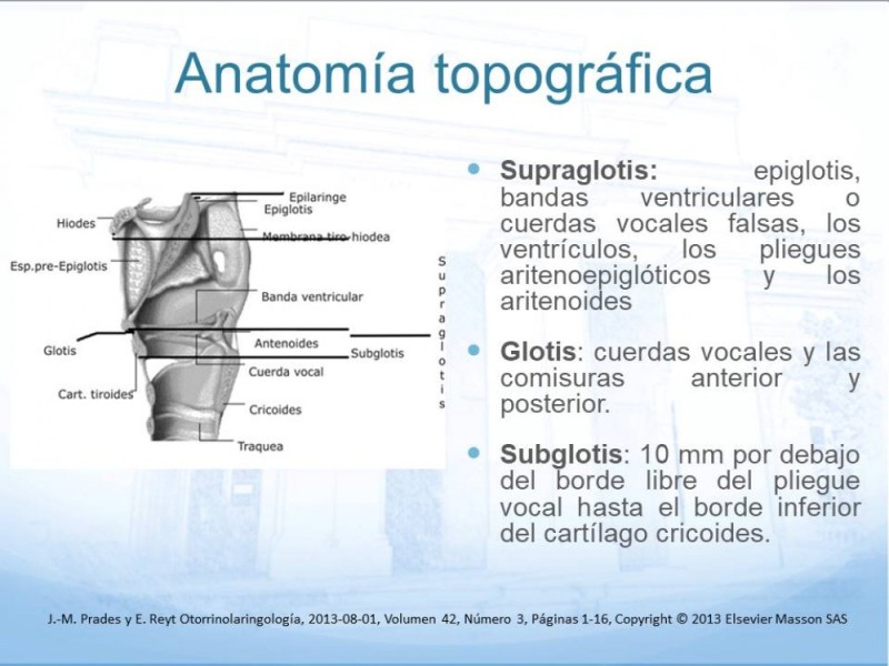 Diapositiva 2 de Cáncer Laringeo